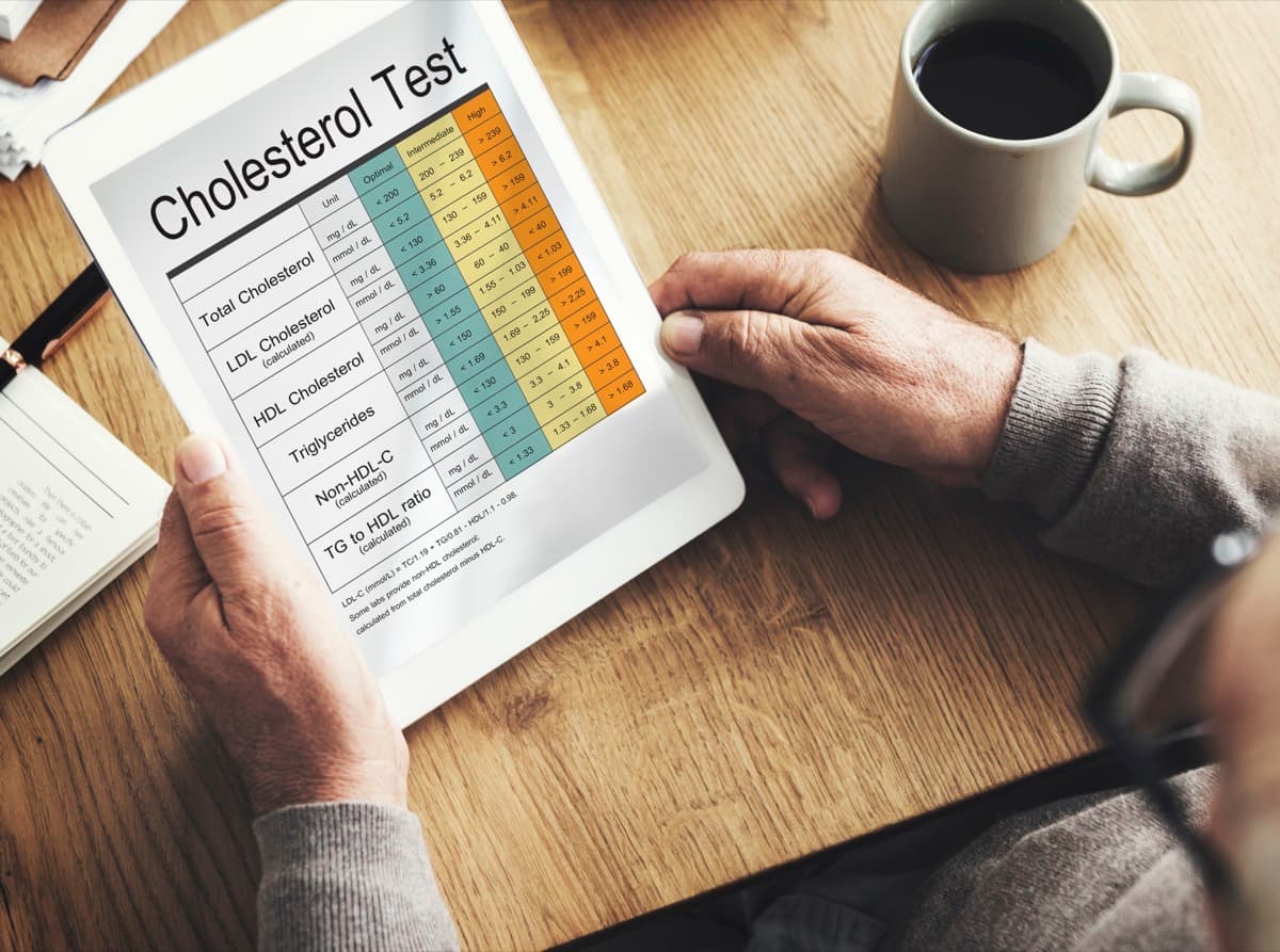 High Cholesterol Management at Nomi Beach Health -- Primary Care