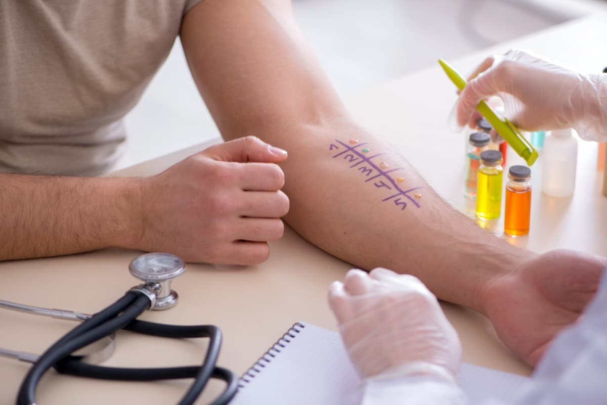 Allergy Testing at Nomi Beach Health -- Primary Care