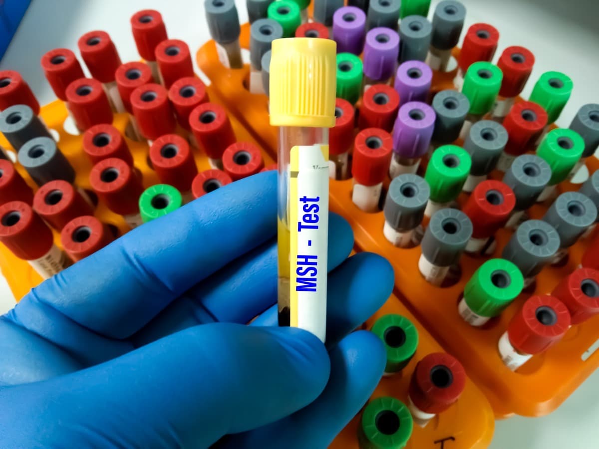 Bremelanotide (PT-141)