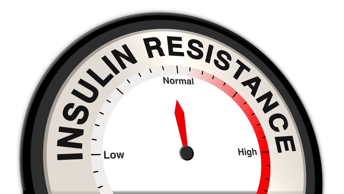 Insulin Resistance